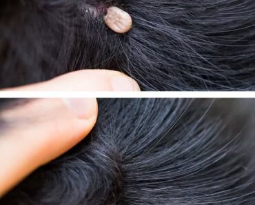 Just discovered this in my son’s hair. What is it? Not sure if we should go to doc